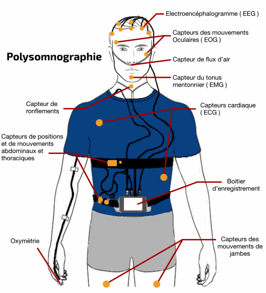 Savez-vous comment dépister l'apnée du sommeil ? - R'Sud Medical